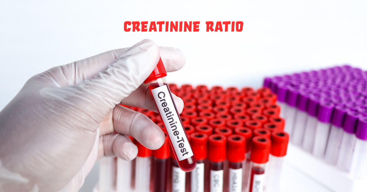 BUN/Creatinine Ratio